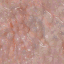 OM9